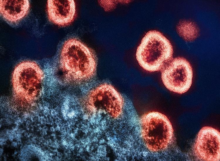 national-institute-of-allergy-and-infectious-diseases-cxUtwHxNGmo-unsplash